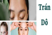 Trán dô là gì, số mệnh tốt hay xấu trong nhân tướng học? trán dô là gì