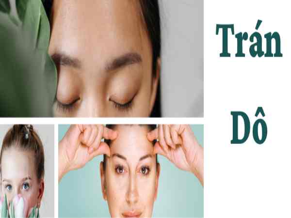 trán dô là gì