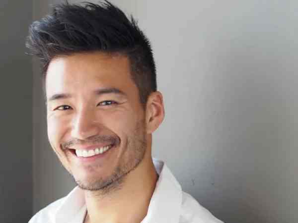 Trán cao là như thế nào? trán cao thì sao