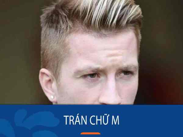 Tại sao lại có trán chữ M?