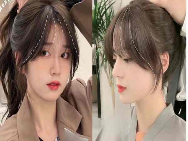 Trán chữ M là gì?