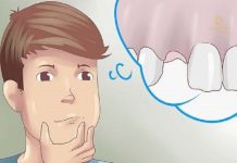 Nằm mơ bị gãy răng cửa là điềm gì, có con gì may mắn? Giải mã chi tiết các trường hợp mơ bị gãy răng cửa là điềm lành hay dữ