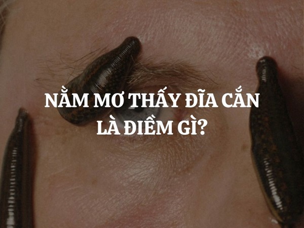 Nằm mơ bị đỉa cắn chân cắn tay là điềm gì, có số nào đại cát?